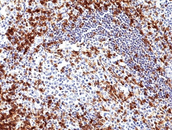Antikörper Anti-CD5 (LEU1) aus Kaninchen (RM354) - unkonj.