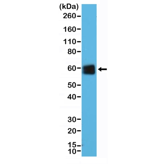Antibody Anti-CD5 (LEU1) from Rabbit - unconj.
