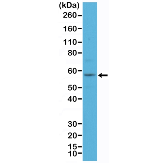 Antikörper Anti-Cytokeratin 4 (KRT4) aus Kaninchen (RM355) - unkonj.