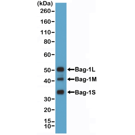 Antikörper Anti-BAG family molecular chaperone regulator 1 (BAG-1) aus Kaninchen (RM356) - unkonj.