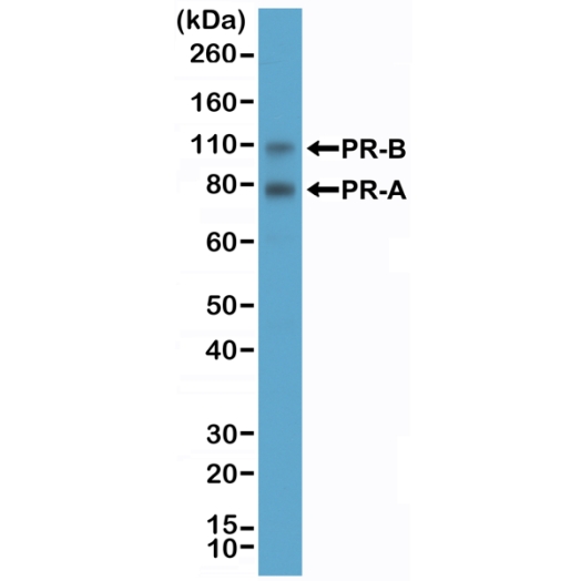 Antibody Anti-Progesterone Receptor (PGR) from Rabbit - unconj.