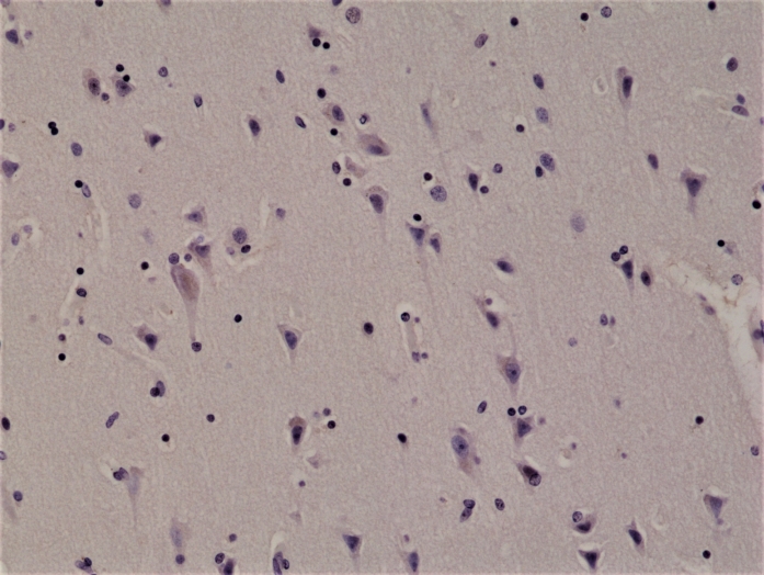 Antikörper Anti-ALK aus Kaninchen (RM361) - unkonj.