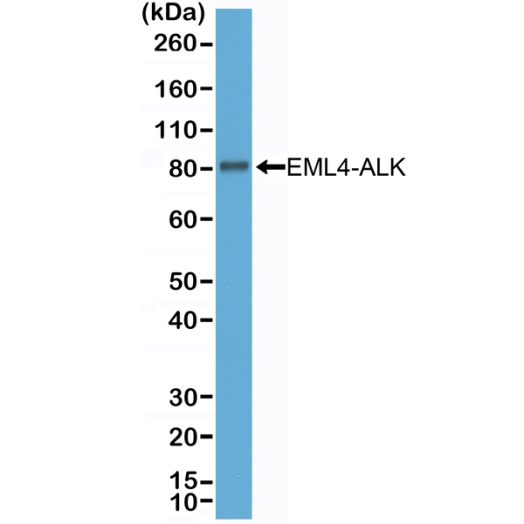 Antikörper Anti-ALK aus Kaninchen (RM361) - unkonj.