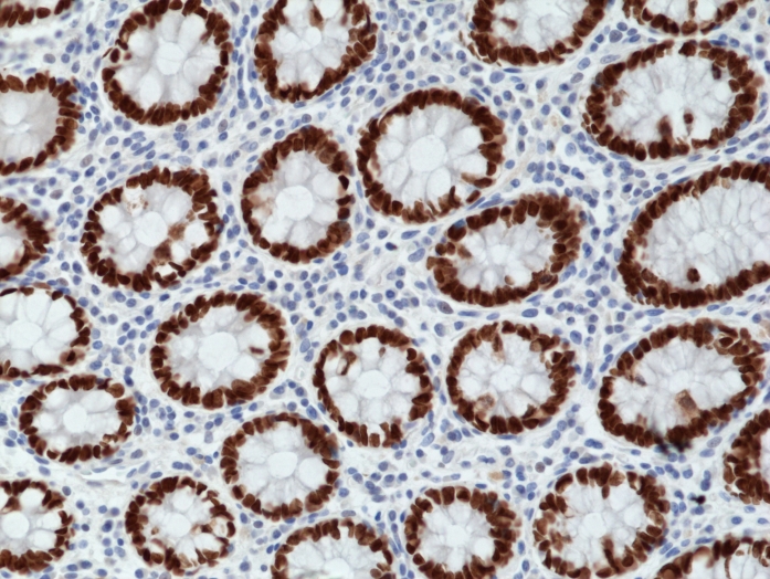 Antikörper Anti-SATB2 aus Kaninchen (RM365) - unkonj.