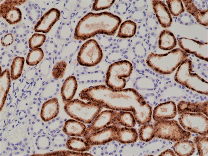 Antikörper Anti-Napsin-A (NAPSA) aus Kaninchen (RM366) - unkonj.