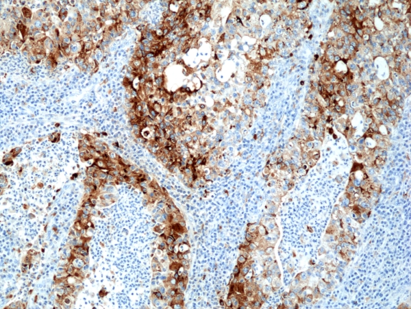 Antikörper Anti-Napsin-A (NAPSA) aus Kaninchen (RM366) - unkonj.