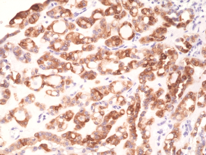 Antikörper Anti-Thrombopoietin (TPO) aus Kaninchen (RM368) - unkonj.
