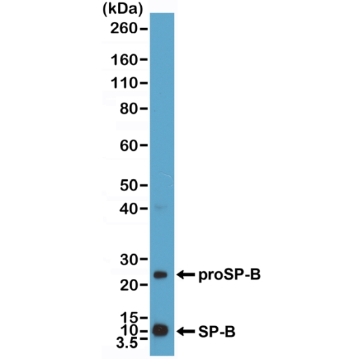 Antikörper Anti-Pulmonary Surfactant Associated Protein B (SPB) aus Kaninchen (RM370) - unkonj.