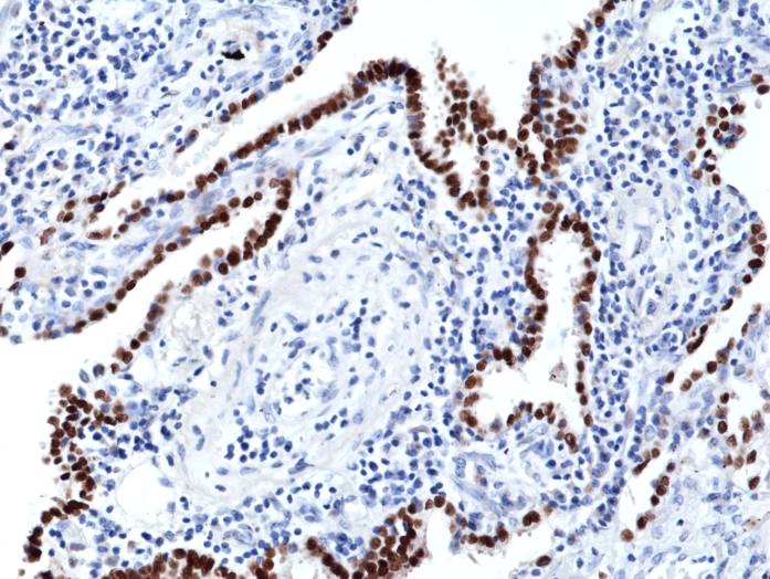 Antibody Anti-Thyroid transcription Factor 1 (TITF1) from Rabbit - unconj.