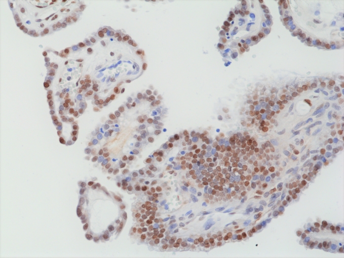Antibody Anti-FOS (V-Fos FBJ Murine Osteosarcoma Viral Oncogene Homolog) from Rabbit - unconj.
