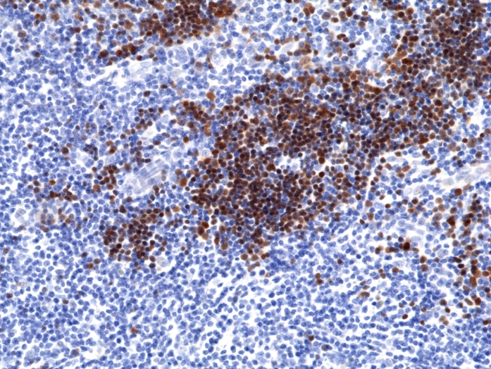 Antikörper Anti-Terminal deoxynucleotidyl transferase (TdT) aus Kaninchen (RM379) - unkonj.