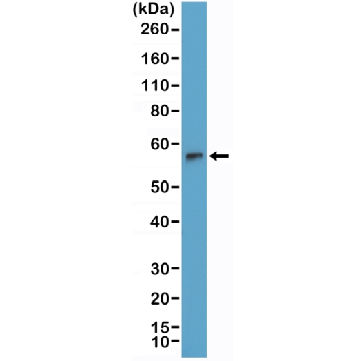 Antikörper Anti-Terminal deoxynucleotidyl transferase (TdT) aus Kaninchen (RM379) - unkonj.