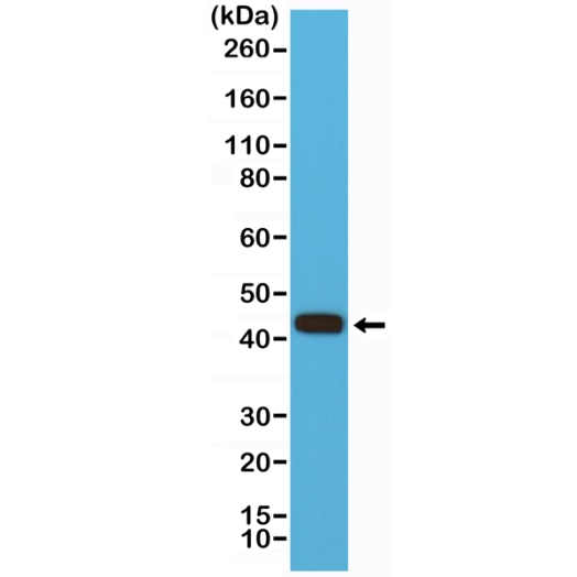 Antikörper Anti-Matrix Metalloproteinase 12 (MMP-12) aus Kaninchen (RM381) - unkonj.