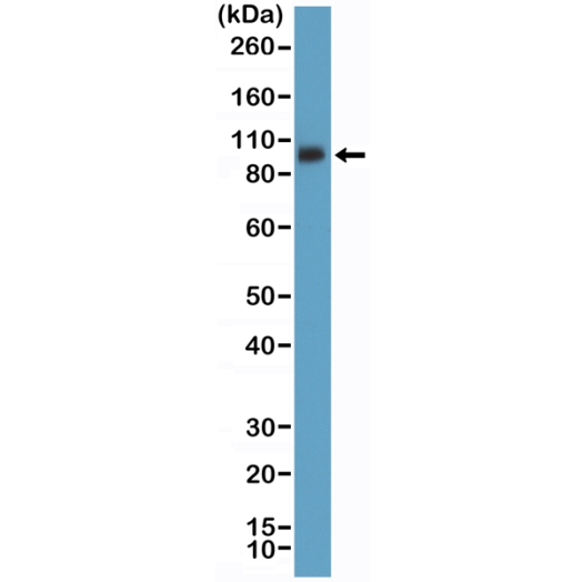 Antikörper Anti-Integrin beta3/CD61 aus Kaninchen (RM382) - unkonj.