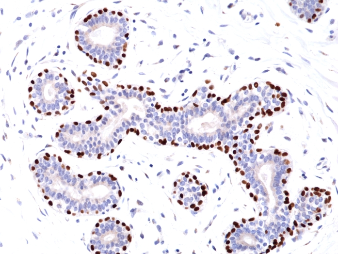 Antikörper Anti-p63 (TP63) aus Kaninchen (RM383) - unkonj.