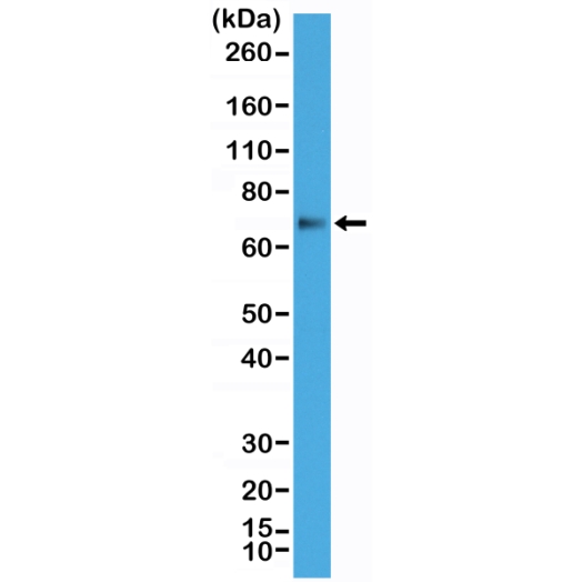 Antikörper Anti-p63 (TP63) aus Kaninchen (RM383) - unkonj.