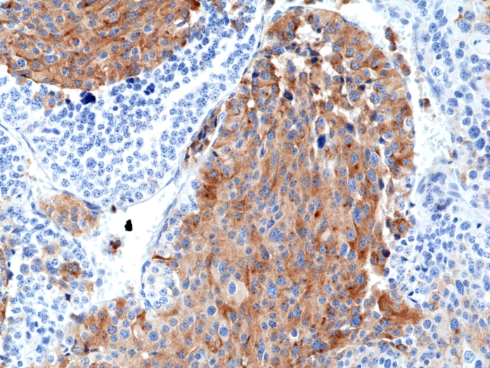 Antikörper Anti-Chromogranin A (CHGA) aus Kaninchen (RM385) - unkonj.