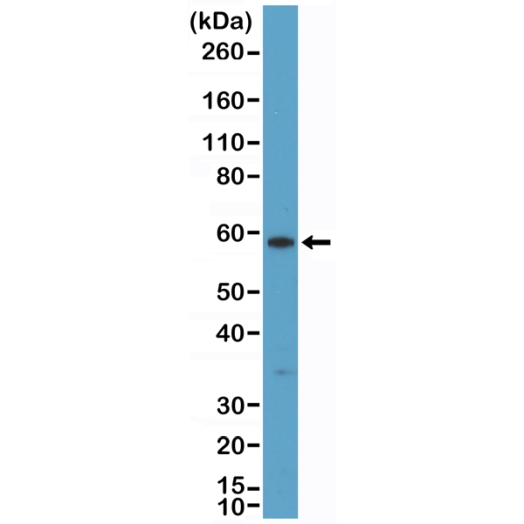 Antikörper Anti-Cytokeratin 10 (KRT10) aus Kaninchen (RM386) - unkonj.