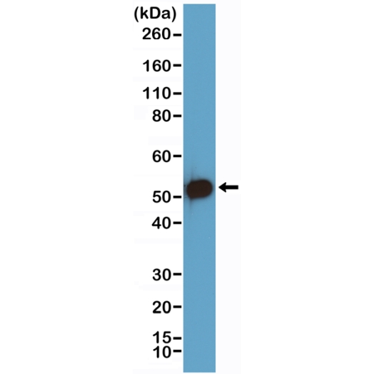 Antikörper Anti-p53 tumor suppressor (p53) aus Kaninchen (RM387) - unkonj.