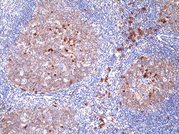 Antikörper Anti-CD38 aus Kaninchen (RM388) - unkonj.