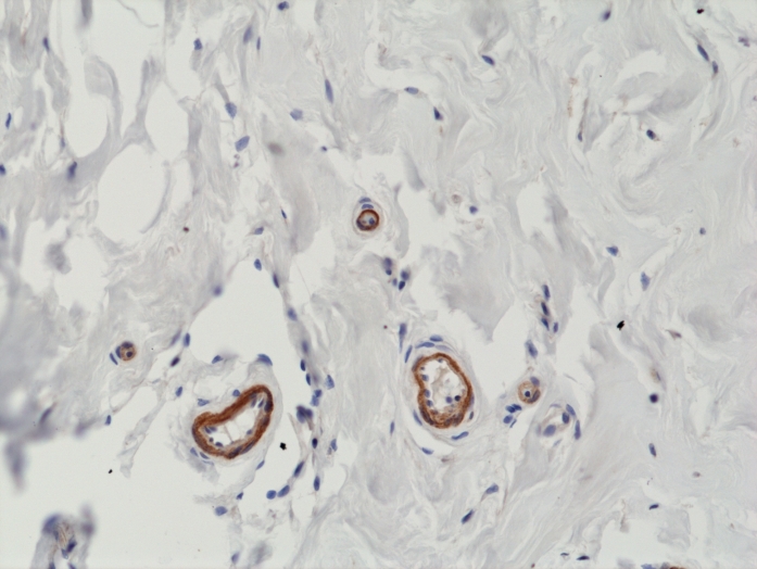 Antikörper Anti-Vascular Endothelial cell Growth Factor (VEGF) aus Kaninchen (RM391) - unkonj.