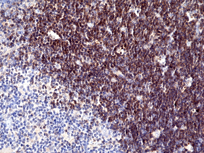 Antikörper Anti-CD1a aus Kaninchen (RM393) - unkonj.