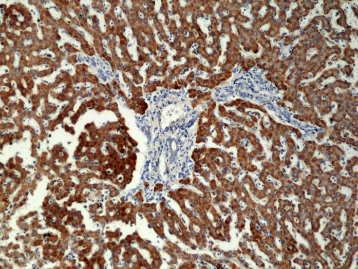 Antikörper Anti-CPS1 aus Kaninchen (RM395) - unkonj.