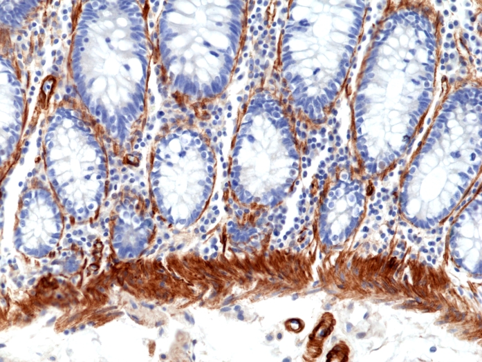 Antikörper Anti-Caldesmon (CALD) aus Kaninchen (RM396) - unkonj.