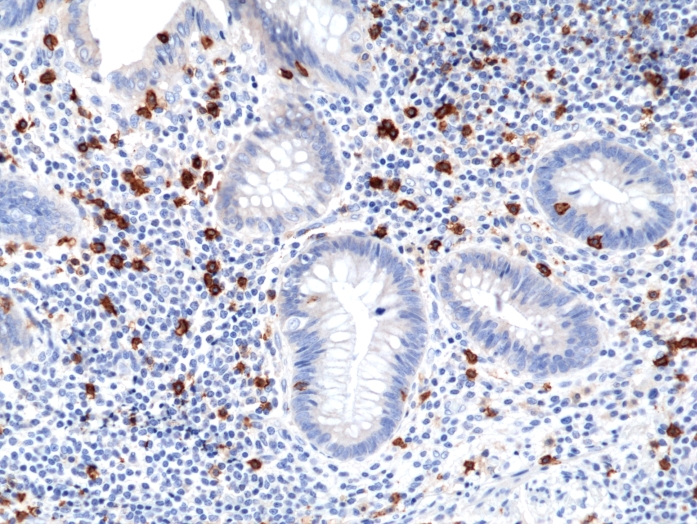 Antikörper Anti-CD8a aus Kaninchen (RM397) - unkonj.