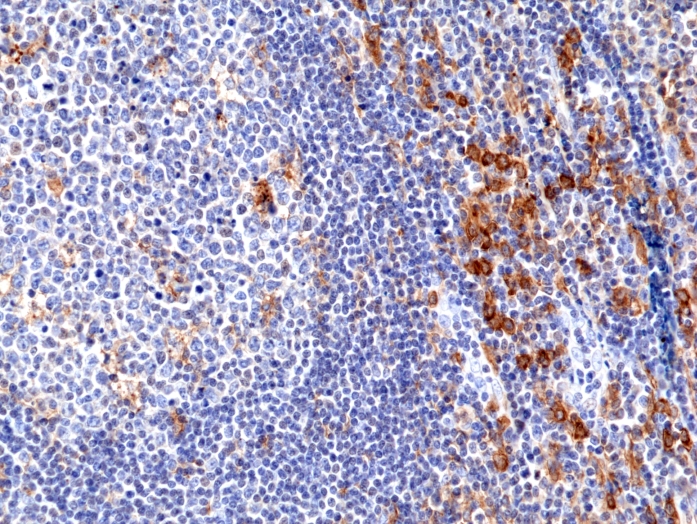 Antikörper Anti-CD33 (SIGLEC3) aus Kaninchen (RM398) - unkonj.