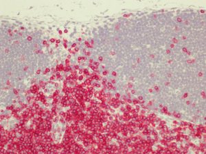 Immunohistochemical staining (IHC) with anti-CD3 e Antibody (clone HH3E) - dianova