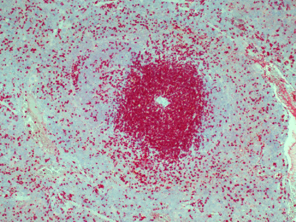 Immunohistochemical staining (IHC) with anti-CD3 e Antibody (clone HH3E) - dianova