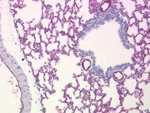 The monoclonal antibody clone SZ31 (DIA-310) reacts specifically with endothelial cells in vessels and capillaries of mouse lung (FFPE tissue). Der monoklonale Antikörper Klon SZ31 (DIA-310) reagiert spezifisch mit Endothelzellen in Gefäßen und Kapillaren der Mäuse Lunge (FFPE Gewebe).