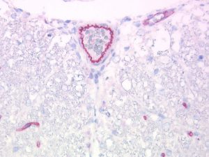 The monoclonal antibody clone SZ31 (DIA-310) reacts specifically with endothelial cells in vessels and capillaries of mouse spinal (FFPE tissue). Der monoklonale Antikörper Klon SZ31 (DIA-310) reagiert spezifisch mit Endothelzellen in Gefäßen und Kapillaren im Spinal der Maus (FFPE Gewebe).