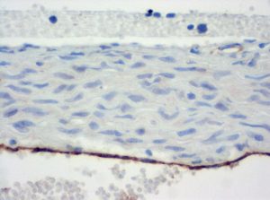The monoclonal antibody clone SZ31 (DIA-310) reacts specifically with endothelial cells in vessels and capillaries of mouse aorta (FFPE tissue). Der monoklonale Antikörper Klon SZ31 (DIA-310) reagiert spezifisch mit Endothelzellen in Gefäßen und Kapillaren der Mausaorta (FFPE Gewebe).