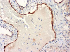 The monoclonal antibody clone SZ31 (DIA-310) reacts specifically with endothelial cells in vessels and capillaries of mouse aorta origin (FFPE tissue). Der monoklonale Antikörper Klon SZ31 (DIA-310) reagiert spezifisch mit Endothelzellen in Gefäßen und Kapillaren der Mausaorta (FFPE Gewebe).