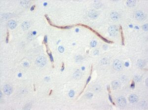 The monoclonal antibody clone SZ31 (DIA-310) reacts specifically with endothelial cells in vessels and capillaries of mouse brain (FFPE tissue). Der monoklonale Antikörper Klon SZ31 (DIA-310) reagiert spezifisch mit Endothelzellen in Gefäßen und Kapillaren des Mäuse Gehirn (FFPE Gewebe).