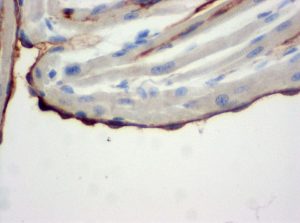 The monoclonal antibody clone SZ31 (DIA-310) reacts specifically with endothelial cells in vessels and capillaries of mouse endocardium (FFPE tissue). Der monoklonale Antikörper Klon SZ31 (DIA-310) reagiert spezifisch mit Endothelzellen in Gefäßen und Kapillaren des Endokard aus der Maus (FFPE Gewebe).
