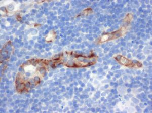 The monoclonal antibody clone SZ31 (DIA-310) reacts specifically with endothelial cells in vessels and capillaries of mouse lymph nodes (FFPE tissue). Der monoklonale Antikörper Klon SZ31 (DIA-310) reagiert spezifisch mit Endothelzellen in Gefäßen und Kapillaren von Lymphknoten der Maus (FFPE Gewebe).