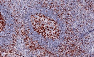 Immunohistochemical staining (IHC) with anti-TIGIT Antibody (clone TG1) - dianova