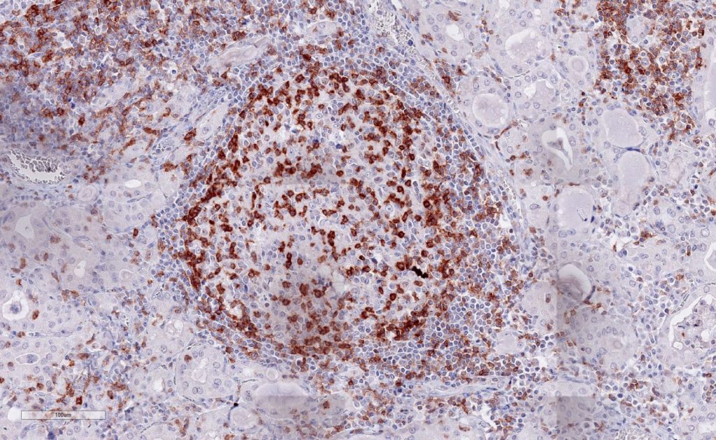 Immunohistochemical staining (IHC) with anti-TIGIT antibody clone TG1 - dianova