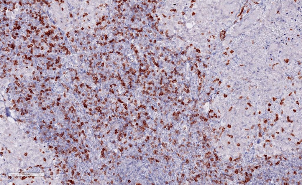 Immunohistochemical staining (IHC) with anti-TIGIT antibody clone TG1 - dianova